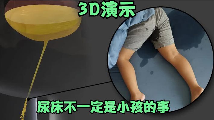3D演示：尿床不一定是小孩的事，为什么成年人会尿床？什么原理？