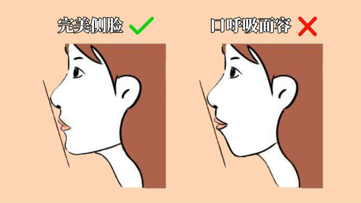 【改善突嘴+下巴后缩】长时间口呼吸让你的颜值直线下降？