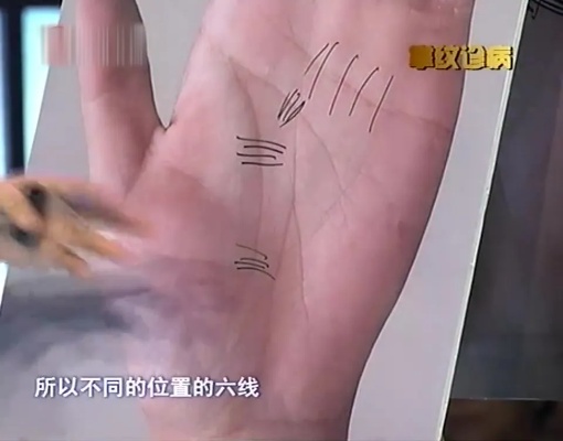 掌纹诊病：专家教你看“手相”，你手心上是否有此线，专家称不好